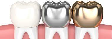 Dental Crowns for Teeth: Types, Costs & Benefits