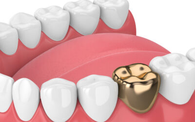 Dental Crown Cost Near Me – 2025 Price Guide & Best Options