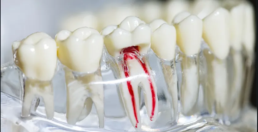 Your Complete Guide to a Root Canal Before and Afte