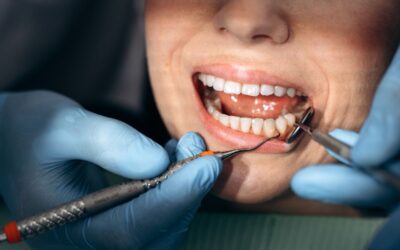 Emergency Dental Extraction Near Me | Open Now